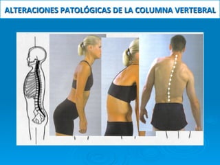ALTERACIONES	
  PATOLÓGICAS	
  DE	
  LA	
  COLUMNA	
  VERTEBRAL	
  
 