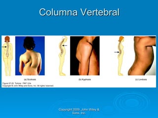 Columna Vertebral




    Copyright 2009, John Wiley &
             Sons, Inc.
 