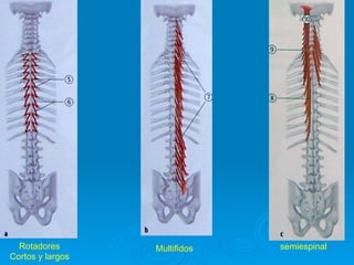 Rotadores       Multifidos   semiespinal
Cortos y largos
 