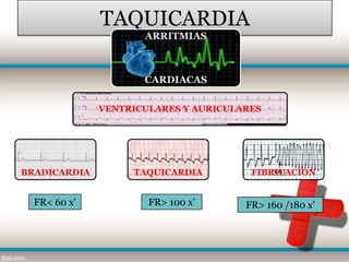 TAQUICARDIA
                     ARRITMIAS



                     CARDIACAS

              VENTRICULARES Y AURICULARES




BRADICARDIA        TAQUICARDIA         FIBRILACIÓN


  FR< 60 x’           FR> 100 x’      FR> 160 /180 x’
 