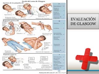 EVALUACIÓN
DE GLASGOW
 