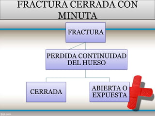 FRACTURA CERRADA CON
      MINUTA
            FRACTURA


     PERDIDA CONTINUIDAD
          DEL HUESO


                 ABIERTA O
  CERRADA        EXPUESTA
 