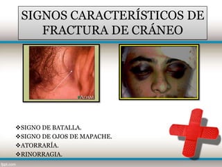 SIGNOS CARACTERÍSTICOS DE
    FRACTURA DE CRÁNEO




SIGNO DE BATALLA.
SIGNO DE OJOS DE MAPACHE.
ATORRARÍA.
RINORRAGIA.
 