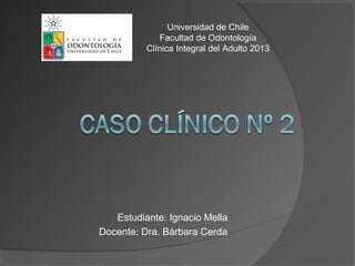 Estudiante: Ignacio Mella
Docente: Dra. Bárbara Cerda
Universidad de Chile
Facultad de Odontología
Clínica Integral del Adulto 2013
 
