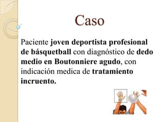 Caso
Paciente joven deportista profesional
de básquetball con diagnóstico de dedo
medio en Boutonniere agudo, con
indicación medica de tratamiento
incruento.
 