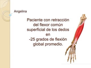 Angelina

           Paciente con retracción
              del flexor común
           superficial de los dedos
                       en
            -25 grados de flexión
              global promedio.
 