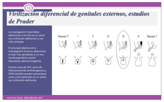 Virilización diferencial de genitales externos, estadios de PraderLa investigación inicial debe determinar si el niño es un varón con virilización deficiente o una niña virilizadaEl principal objetivo de la investigación inicial es determinar el sexo más apropiado y, en una hembra genética, excluir hiperplasia adrenal congénitaFormas raras de HAC como 3b-hidroxiesteroide deshidrogenasa y STAR también pueden presentarse como crisis adrenales en un varón con virilización deficiente12ArchDisChild. 2004;89;401-407