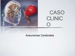 CASO
CLINIC
O
Aneurismas Cerebrales
 
