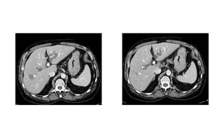 Caso cerrado 21 abril