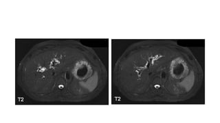 Caso cerrado 21 abril