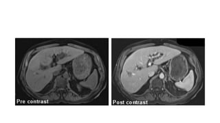 Caso cerrado 21 abril