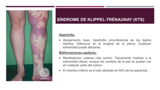 Hipertrofia:
 Alargamiento óseo, hipertrofia circunferencial de los tejidos
blandos. Diferencia en la longitud de la pierna. Cualquier
extremidad puede afectarse.
Malformaciones capilares:
 Manifestación cutánea más común. Típicamente implican a la
extremidad afecta, aunque los cambios de la piel se pueden ver
en cualquier parte del cuerpo.
 El miembro inferior es el sitio afectado en 95% de los pacientes.
SÍNDROME DE KLIPPEL-TRÉNAUNAY (KTS)
 