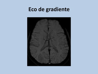 Caso cerrado: DNET | PPT