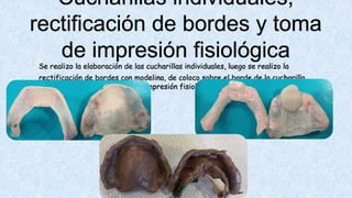 CASO CLINICo, con paciente indicado para clínica de total (1).pdf