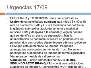 Urgencias 17/09
•

ECOGRAFIA y TC CERVICAL sin y con contraste ev.
Lesión de características quísticas que mide 35 x 40 x 48
mm de diámetros T, AP y L. Está localizada por detrás de
la glándula submaxilar izquierda, anterior y medial al
músculo ECM y desplaza a la carótida y yugular con las
que se identifica un plano de separación. Tras la
administración de contraste ev realza en periferia con las
paredes algo engrosadas observándose además realce en
ECM que está aumentado de tamaño. Pequeñas
adenopatías adyacentes de menos de 1 cm. No se ven
adenopatías aumentadas de tamaño de forma significativa.
Vía aérea permeable de calibre normal.
Conclusión.- Lesión compatible con QUISTE DEL
SEGUNDO ARCO BRANQUIAL con signos radiológicos
sugestivos de infección. Aconsejamos PAAF (citado 29/9) .

 