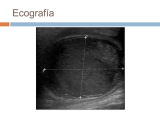 Ecografía

 
