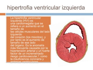 hipertrofia ventricular izquierda
 La hipertrofia ventricular
izquierda (HVI) es
una cardiomegalia que se
refiere a un aumento en el
tamaño de
las células musculares del lado
izquierdo
del corazón (los miocitos), y
por tanto es el aumento de
tamaño de ese lado
del órgano. Es la anomalía
más frecuente causada por la
hipertensión arterial y un fuerte
factor de un incrementado
riesgo cardiovascular,1 como
la insuficiencia coronaria y
arritmias ventriculares.
 