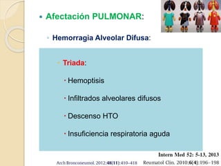  Afectación PULMONAR:
◦ Hemorragia Alveolar Difusa:
Capilaritis alveolar  Vasculitis Sistémicas
Daño en la microcirculación alveolar
Inflamación y necrosis de los vasos sanguíneos
pulmonares (arteriolas, capilares y vénulas)
Disrupción membrana alveolo-capilar
Extravasación de glóbulos rojos al
espacio alveolar pulmonar
 Triada:
 Hemoptisis
 Infiltrados alveolares difusos
 Descenso HTO
 Insuficiencia respiratoria aguda
 