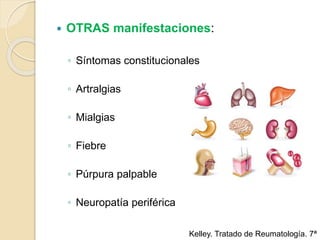  OTRAS manifestaciones:
◦ Síntomas constitucionales
◦ Artralgias
◦ Mialgias
◦ Fiebre
◦ Púrpura palpable
◦ Neuropatía periférica
Kelley. Tratado de Reumatología. 7ª
 