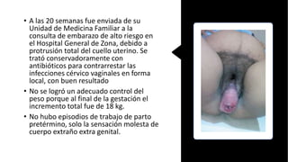 • A las 20 semanas fue enviada de su
Unidad de Medicina Familiar a la
consulta de embarazo de alto riesgo en
el Hospital General de Zona, debido a
protrusión total del cuello uterino. Se
trató conservadoramente con
antibióticos para contrarrestar las
infecciones cérvico vaginales en forma
local, con buen resultado
• No se logró un adecuado control del
peso porque al final de la gestación el
incremento total fue de 18 kg.
• No hubo episodios de trabajo de parto
pretérmino, solo la sensación molesta de
cuerpo extraño extra genital.
 