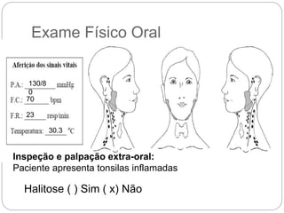Exame Físico Oral
70
23
30.3
Inspeção e palpação extra-oral:
Paciente apresenta tonsilas inflamadas
Halitose ( ) Sim ( x) Não
130/8
0
 