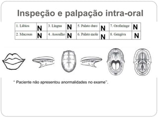 Inspeção e palpação intra-oral
N N
N N N
N N
N
‘‘ Paciente não apresentou anormalidades no exame’’.
 