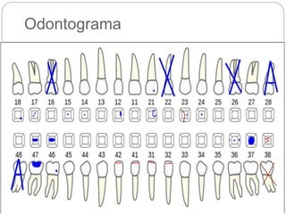 Odontograma
 