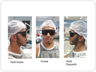 Perfil Direito Frontal Perfil
Esquerdo
 