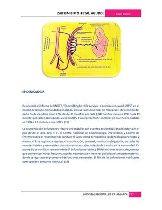 [SUFRIMIENTO FETAL AGUDO] Caso Clínico
HOSPITALREGIONALDE CAJAMARCA 12
EPIDEMIOLOGIA
De acuerdoal informe de UNICEF,“Committingtochild survival: a promise renewed, 2015”, en el
mundo,latasa de mortalidadneonatal porasfixiayconsecuencias de mala praxis de atención del
parto ha descendido en un 47%, desde 36 muertes por cada 1.000 nacidos vivos en 1990 hasta 19
muertesporcada 1.000 nacidosvivosen2015. Eso representa5.1 millonesde muertesneonatales
en 1990 a 2.7 millones en el 2015. (19)
La ocurrencia de defunciones fetales y neonatales son eventos de notificación obligatoria en el
país desde el año 2010 y es el Centro Nacional de Epidemiología, Prevención y Control de
Enfermedadesel responsablede conducirel Subsistema de Vigilancia Epidemiológica Perinatal y
Neonatal. Esta vigilancia recolecta la notificación, semanal, nominal y obligatoria, de todas las
muertes fetales y neonatales ocurridas en un establecimiento de salud o en la comunidad. En
promediose notificansemanalmente 64defuncionesfetalesy60 defuncionesneonatales;eventos
que ocurrencon mayor frecuenciaque lasneumoníasenmenoresde 5años o la muerte materna,
donde se registranenpromedio 6 defunciones semanales. El 48% de las defunciones notificadas
corresponden a muerte neonatal. (19)
 
