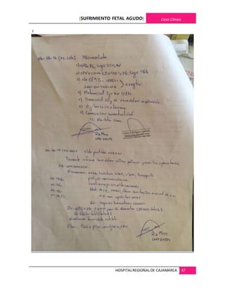 [SUFRIMIENTO FETAL AGUDO] Caso Clínico
HOSPITALREGIONALDE CAJAMARCA 47
z
 