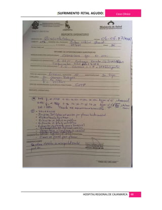 [SUFRIMIENTO FETAL AGUDO] Caso Clínico
HOSPITALREGIONALDE CAJAMARCA 48
 