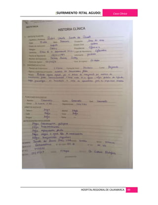 [SUFRIMIENTO FETAL AGUDO] Caso Clínico
HOSPITALREGIONALDE CAJAMARCA 49
 