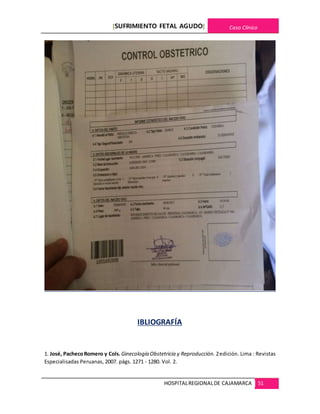 [SUFRIMIENTO FETAL AGUDO] Caso Clínico
HOSPITALREGIONALDE CAJAMARCA 51
IBLIOGRAFÍA
1. José, PachecoRomero y Cols. Ginecología Obstetricia y Reproducción. 2edición. Lima : Revistas
Especialisadas Peruanas, 2007. págs. 1271 - 1280. Vol. 2.
 