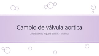 Cambio de válvula aortica
Angie Daniela higuera fuentes - 15021051
 