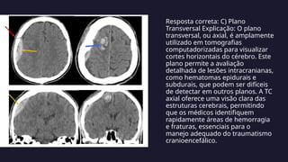 Resposta correta: C) Plano
Transversal Explicação: O plano
transversal, ou axial, é amplamente
utilizado em tomografias
computadorizadas para visualizar
cortes horizontais do cérebro. Este
plano permite a avaliação
detalhada de lesões intracranianas,
como hematomas epidurais e
subdurais, que podem ser difíceis
de detectar em outros planos. A TC
axial oferece uma visão clara das
estruturas cerebrais, permitindo
que os médicos identifiquem
rapidamente áreas de hemorragia
e fraturas, essenciais para o
manejo adequado do traumatismo
cranioencefálico.
 