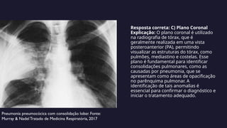 Resposta correta: C) Plano Coronal
Explicação: O plano coronal é utilizado
na radiografia de tórax, que é
geralmente realizada em uma vista
posteroanterior (PA), permitindo
visualizar as estruturas do tórax, como
pulmões, mediastino e costelas. Esse
plano é fundamental para identificar
consolidações pulmonares, como as
causadas por pneumonia, que se
apresentam como áreas de opacificação
no parênquima pulmonar. A
identificação de tais anomalias é
essencial para confirmar o diagnóstico e
iniciar o tratamento adequado.
Pneumonia pneumocócica com consolidação lobar. Fonte:
Murray & Nadel Tratado de Medicina Respiratória, 2017
 
