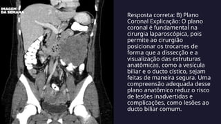 Resposta correta: B) Plano
Coronal Explicação: O plano
coronal é fundamental na
cirurgia laparoscópica, pois
permite ao cirurgião
posicionar os trocartes de
forma que a dissecção e a
visualização das estruturas
anatômicas, como a vesícula
biliar e o ducto cístico, sejam
feitas de maneira segura. Uma
compreensão adequada desse
plano anatômico reduz o risco
de lesões inadvertidas e
complicações, como lesões ao
ducto biliar comum.
 