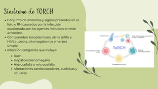 Caso Clínico de síndrome de TORCH con énfasis en Rubéola | PDF