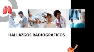 01
HALLAZGOS RADIOGRÁFICOS
 