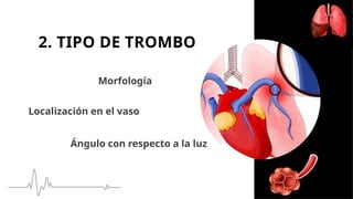 Localización en el vaso
Morfología
Ángulo con respecto a la luz
2. TIPO DE TROMBO
 