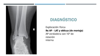 Caso Clinico de ANATOMÍA Y FRACTURA DE TOBILLO.pptx