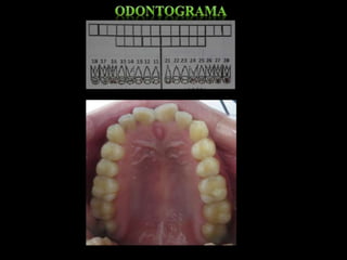 Caso clínico   adulto - Odontología 