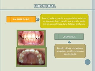 PALADAR DURO
OROFARINGE
Forma ovalada, papila y rugosidades palatinas
en aparente buen estado, presenta la papila
incisal, consistencia dura. Paladar profundo.
Rosado pálido, humectado,
amígdalas sin alteración con
buen estado.
 