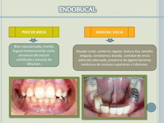 PISO DE BOCA
Bien vascularizado, frenillo
lingual medianamente corto,
presencia del ostium
umbilicalis y conucto de
Wharton.
GINGIVA: ENCIA
Rosado coral, contorno regular, textura lisa, tamaño
delgada, consistencia blanda, cantidad de encia
adherida adecuada, presencia de pigmentaciones
melánicas de incisivos superiores e inferiores.
 