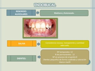REBORDES
ALVEOLARES
SALIVA
Mediano y festoneado.
Consistencia viscosa, transparente y cantidad
adecuada.
DIENTES:
Nº temporales: 12
N de permanentes: 12
Nº en proceso de erupción:0
Dientes pequeños de forma cuadrada y coloración
blanco marfil
 