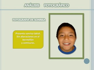 Presenta sonrisa labial.
Sin alteraciones en el
bermellón
y comisuras.
 