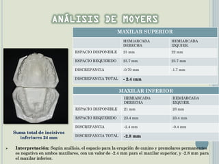 MAXILAR SUPERIOR
HEMIARCADA
DERECHA
HEMIARCADA
IZQUIER.
ESPACIO DISPONIBLE 23 mm 22 mm
ESPACIO REQUERIDO 23.7 mm 23.7 mm
DISCREPANCIA -0.70 mm -1.7 mm
DISCREPANCIA TOTAL - 2.4 mm
MAXILAR INFERIOR
HEMIARCADA
DERECHA
HEMIARCADA
IZQUIER.
ESPACIO DISPONIBLE 21 mm 23 mm
ESPACIO REQUERIDO 23.4 mm 23.4 mm
DISCREPANCIA -2.4 mm -0.4 mm
DISCREPANCIA TOTAL -2.8 mm
Suma total de incisivos
inferiores 24 mm
 Interpretación: Según análisis, el espacio para la erupción de canino y premolares permanentes
es negativa en ambos maxilares, con un valor de -2.4 mm para el maxilar superior, y -2.8 mm para
el maxilar inferior.
 