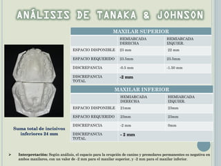 MAXILAR SUPERIOR
HEMIARCADA
DERECHA
HEMIARCADA
IZQUIER.
ESPACIO DISPONIBLE 23 mm 22 mm
ESPACIO REQUERIDO 23.5mm 23.5mm
DISCREPANCIA -0.5 mm -1.50 mm
DISCREPANCIA
TOTAL
-2 mm
MAXILAR INFERIOR
HEMIARCADA
DERECHA
HEMIARCADA
IZQUIER.
ESPACIO DISPONIBLE 21mm 23mm
ESPACIO REQUERIDO 23mm 23mm
DISCREPANCIA -2 mm 0mm
DISCREPANCIA
TOTAL
- 2 mm
 Interpretación: Según análisis, el espacio para la erupción de canino y premolares permanentes es negativa en
ambos maxilares, con un valor de -2 mm para el maxilar superior, y -2 mm para el maxilar inferior.
Suma total de incisivos
inferiores 24 mm
 