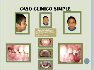 CASO CLINICO SIMPLE
Pc. Paredes Solis Flavio.
Ope. Robles Aguirre Deany.
HC: 51325
8 años y 2 meses
 