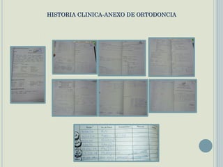 HISTORIA CLINICA-ANEXO DE ORTODONCIA
 